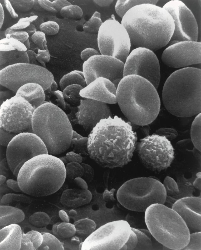a black and white photo showing blood cells